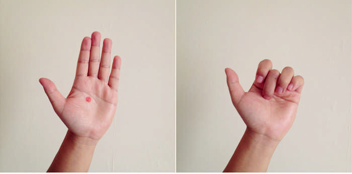 Массаж пальцев рук при повышенном давлении